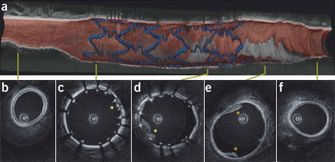      ,       OFDI.        (   Seok H. Yun et al.).